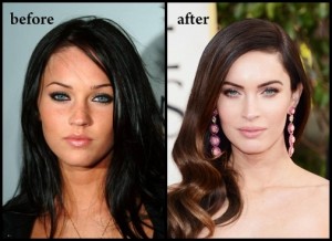 megan_fox_before_after_plastic_surgery